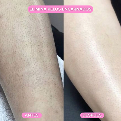 GlowTrim  – Recortador de bikini y cuerpo 2 en 1