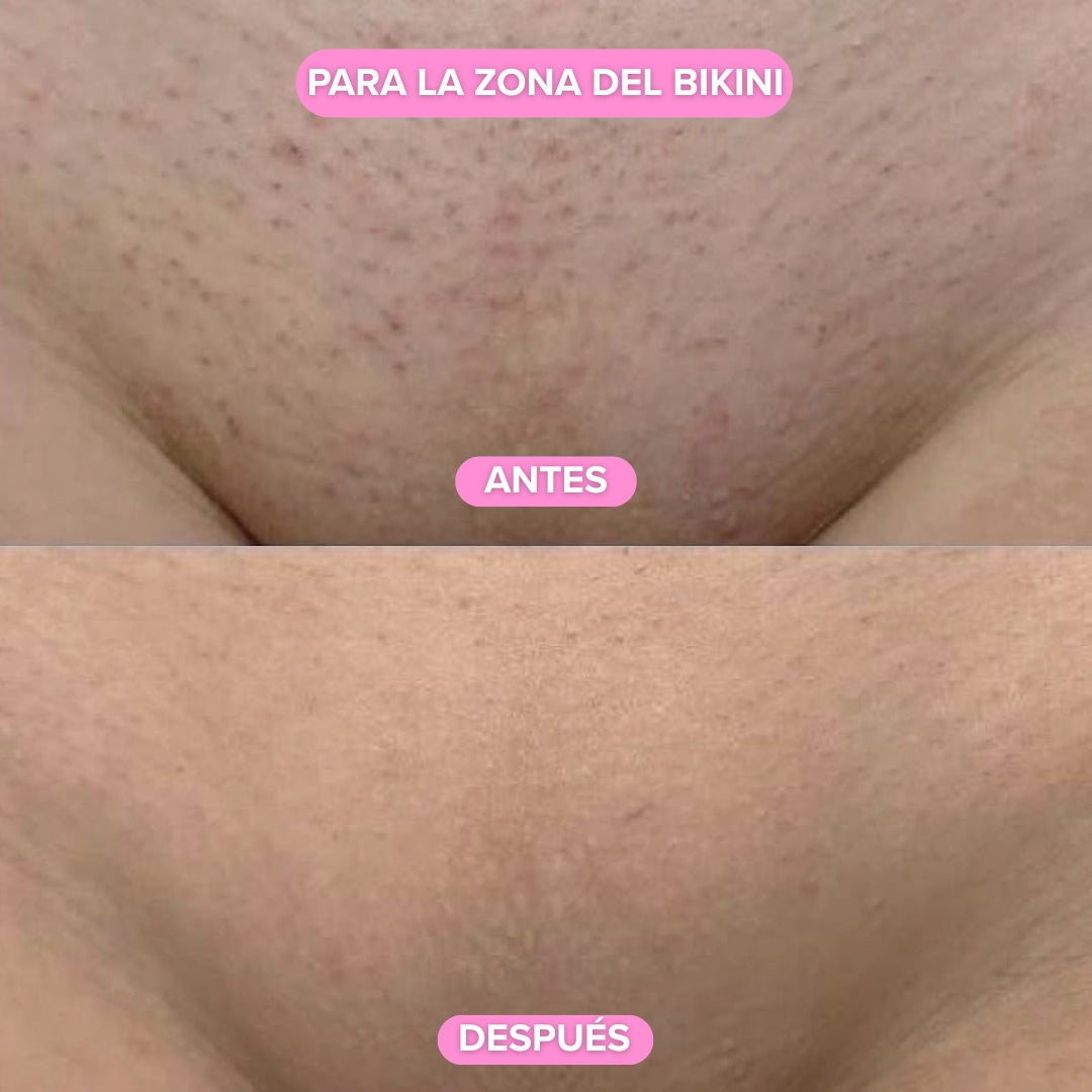 GlowTrim  – Recortador de bikini y cuerpo 2 en 1